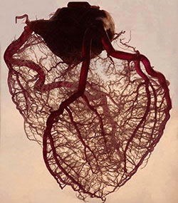 hjertestarter
